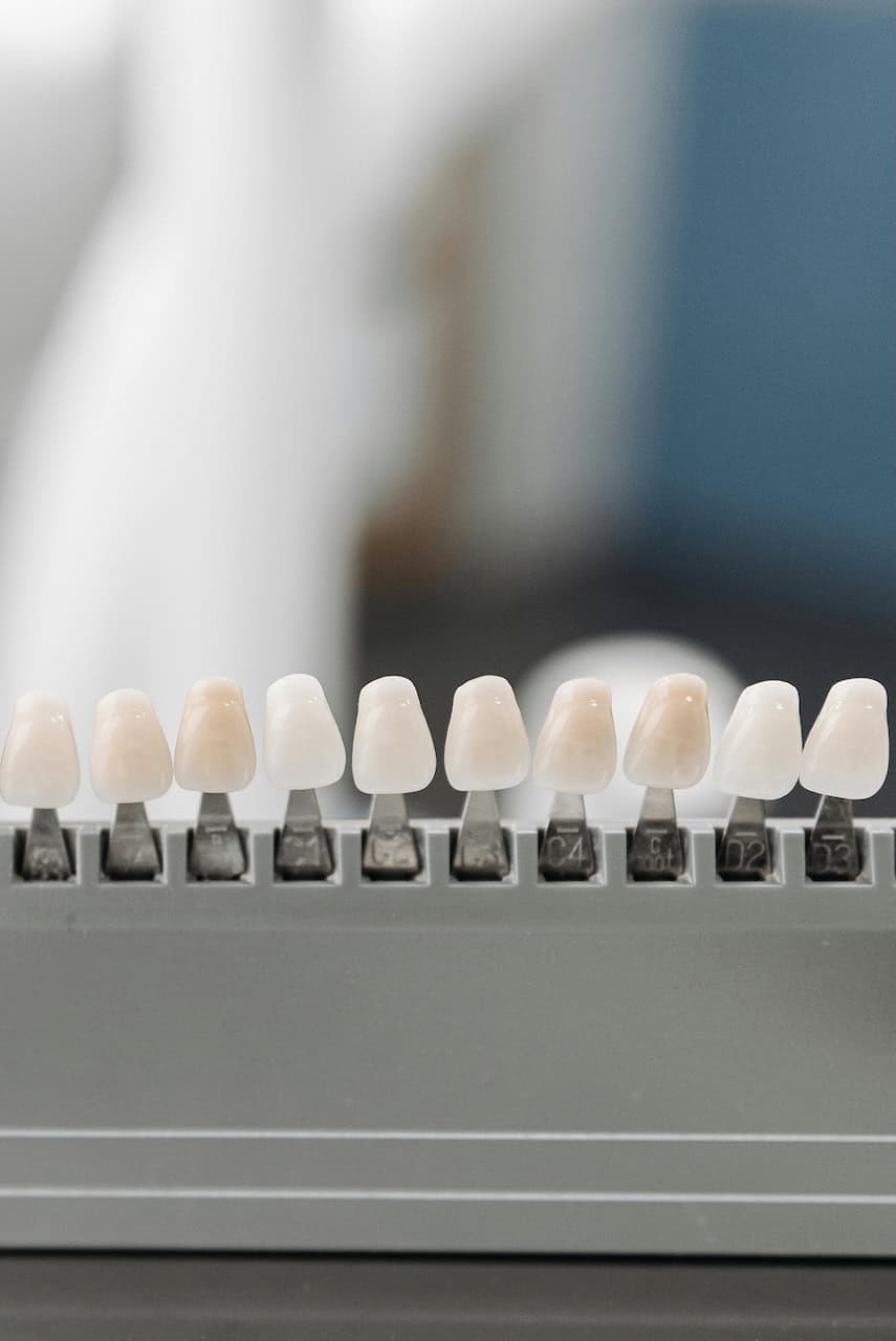 Dental Veneers