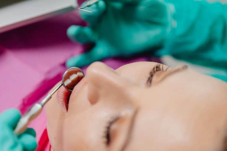How Long Do Veneers Last