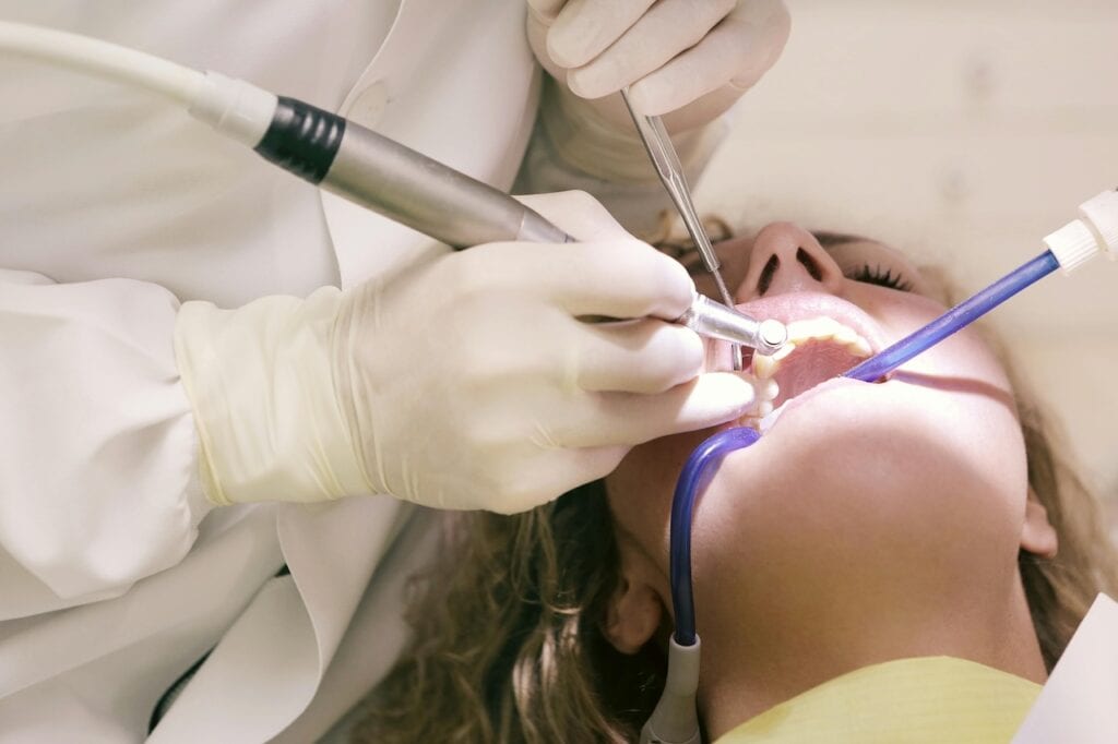 Veneers Aftercare