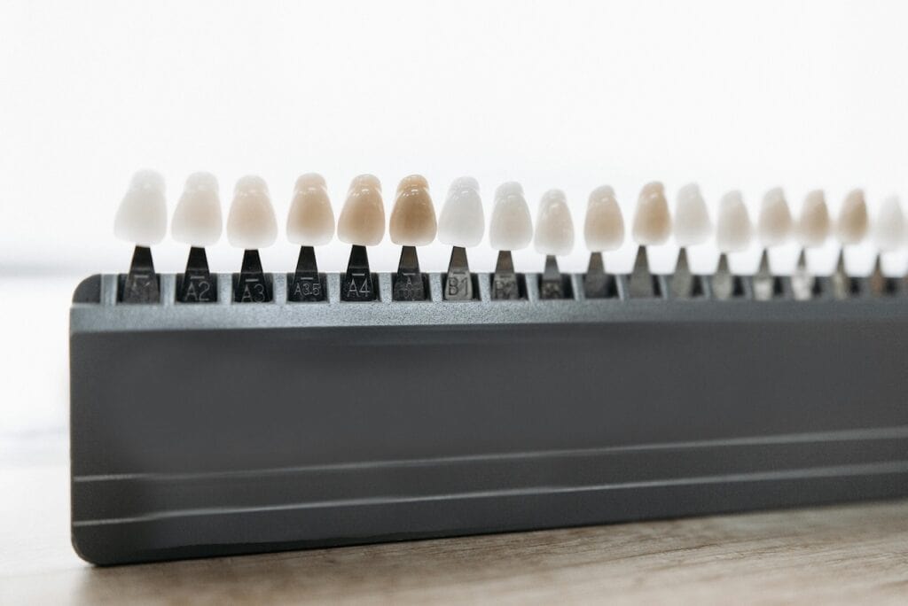Veneers Case Studies