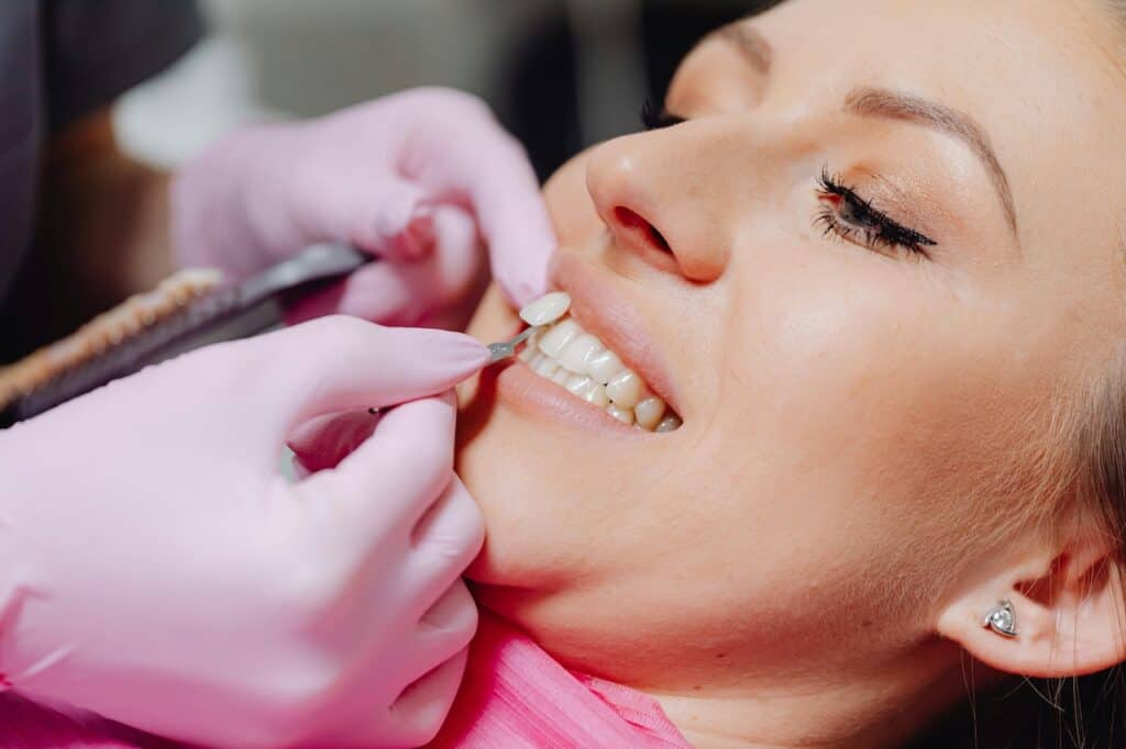 Veneers Procedure Process