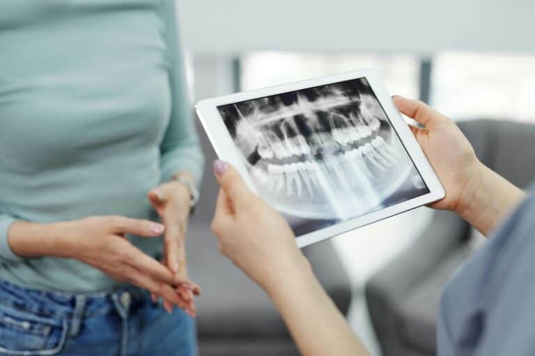 Veneers Pros Cons
