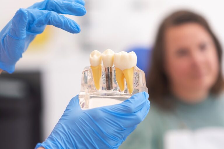 Implants Dentist Office