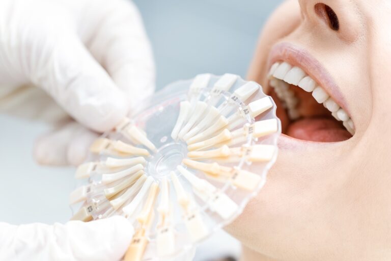 Long Island Teeth Whitening