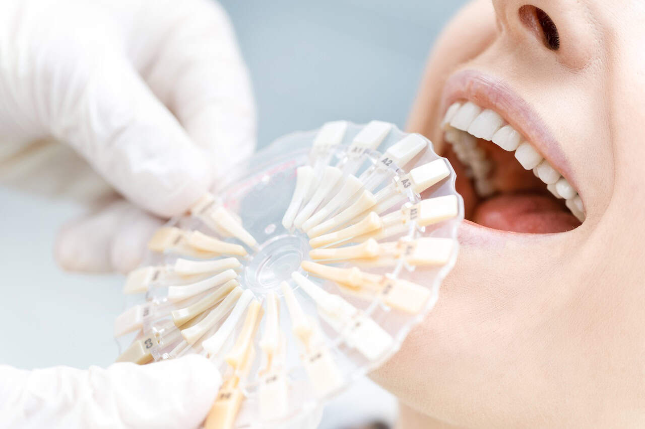 Long Island Teeth Whitening