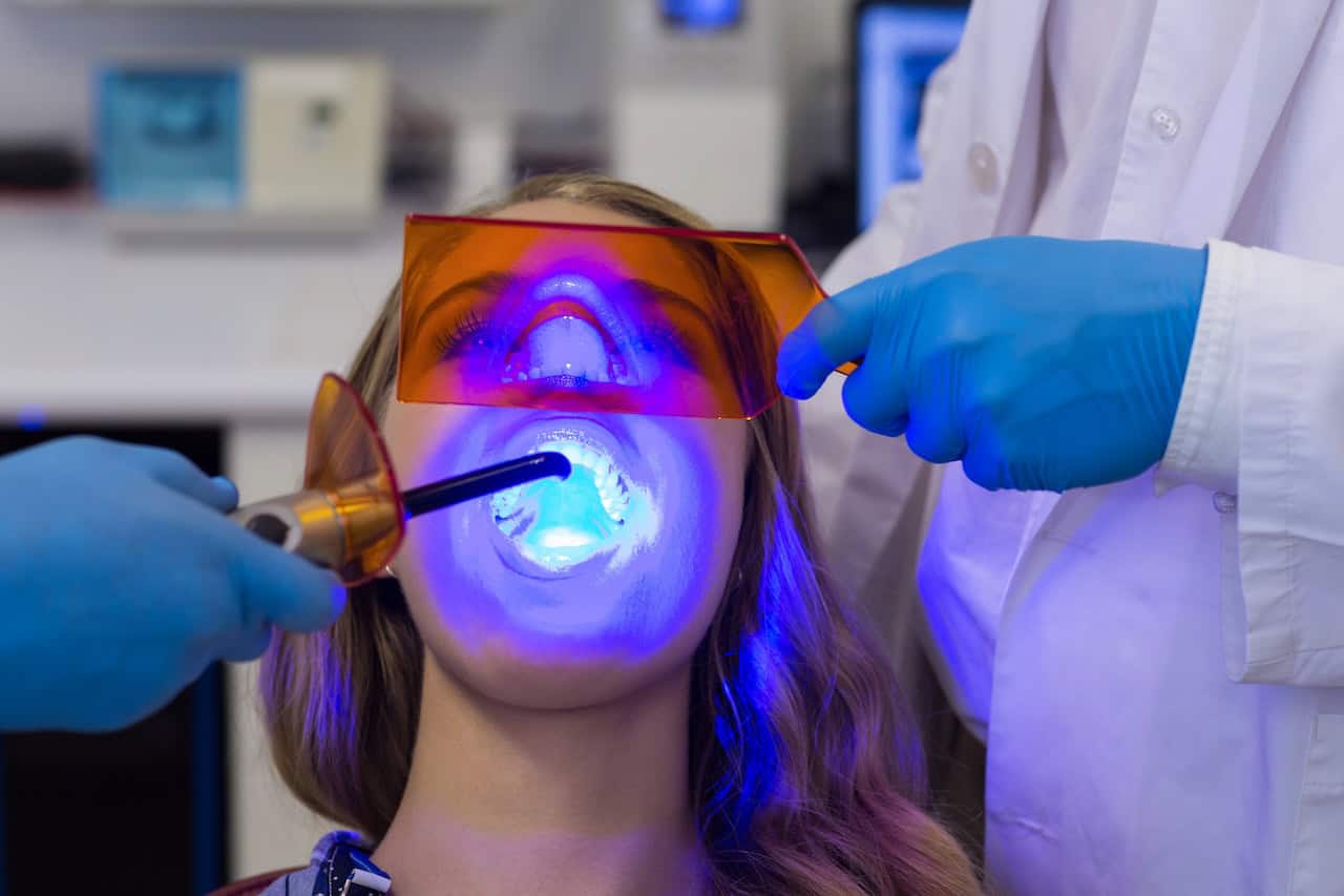Teeth Whitening