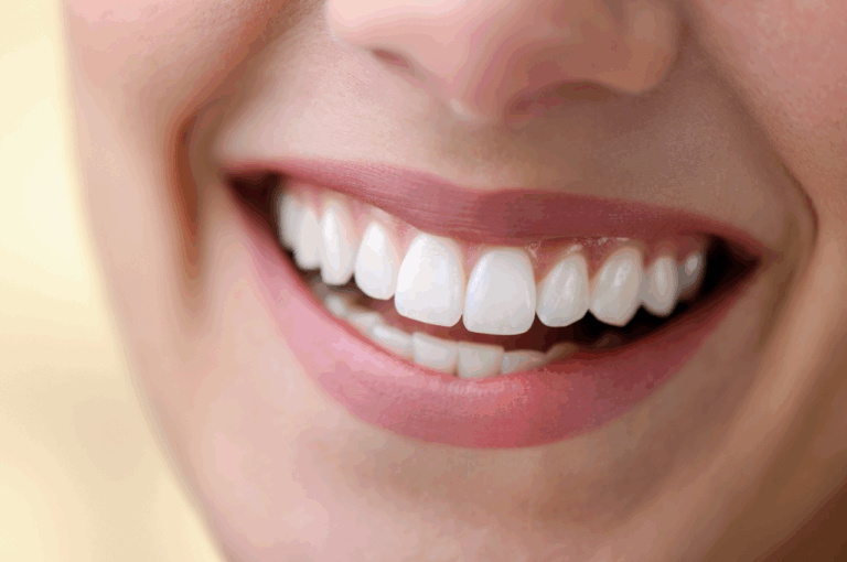 veneers vs bonding