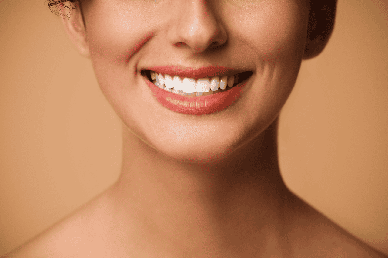 Permanent Veneers vs Snap-On Veneers: the Real Difference