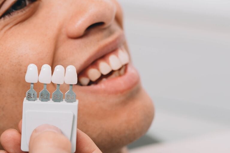 doctors sampling veneers near patient's teeth