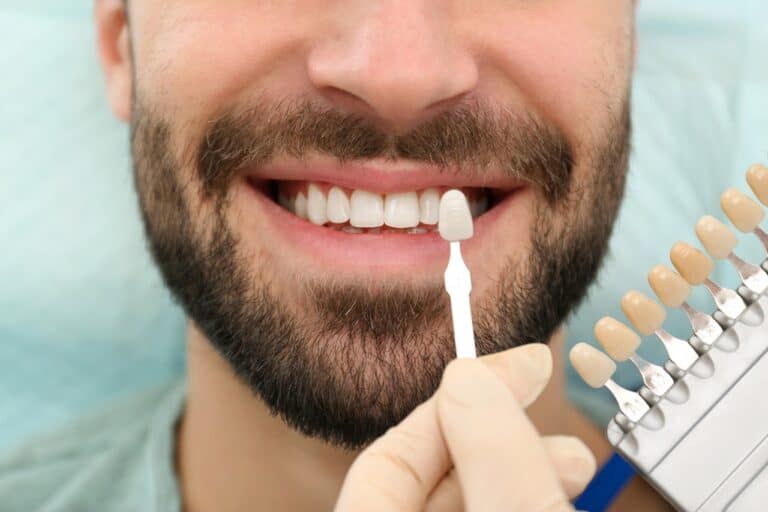 dentist matching man's teeth color