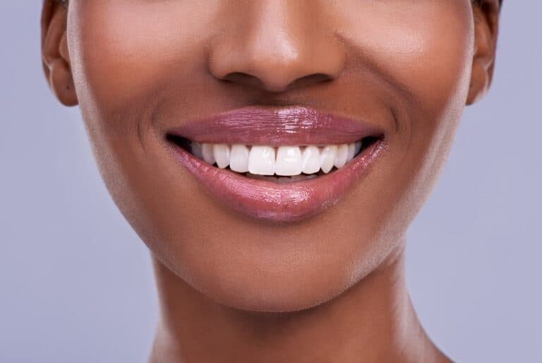 dark skinned woman with pearly whites