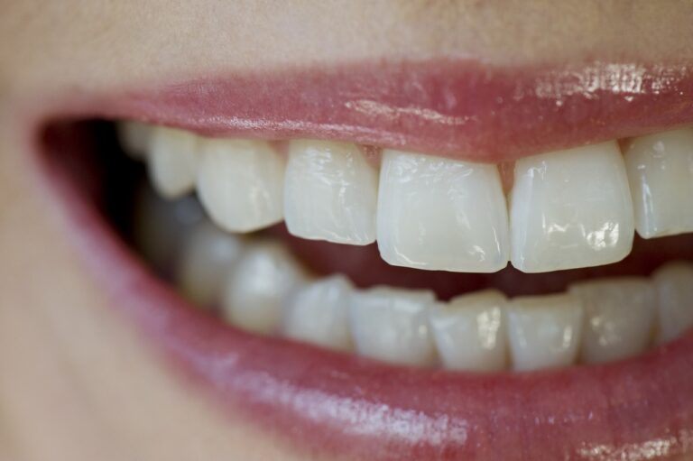 woman's pearly whites