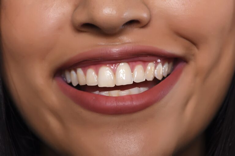 close up of a young woman's beautiful smile