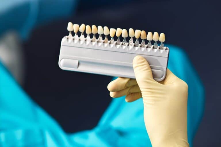 dentist's hand holding dental shade guide