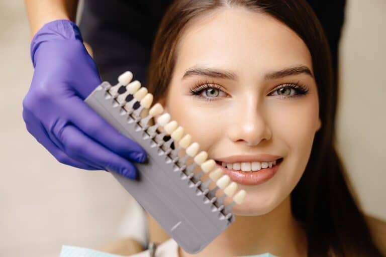 pretty woman and dental shade guide